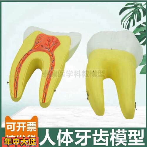 磨牙模型可拆卸切牙尖牙臼齿三只放大可拆卸医用口腔牙齿牙医牙科