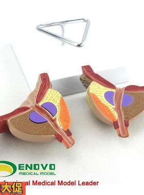 ENOVO颐诺医学前列腺解剖模型BPH前列腺检查模型男性前列腺生殖