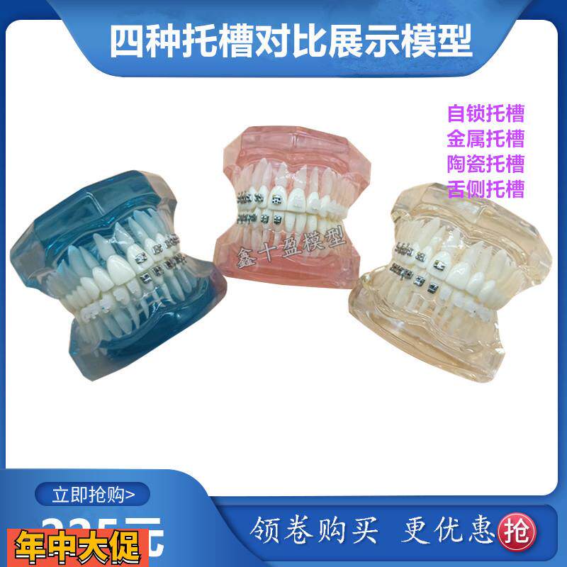 牙科正畸模型4种托槽对比模型金属陶瓷舌侧自锁托槽示范模型