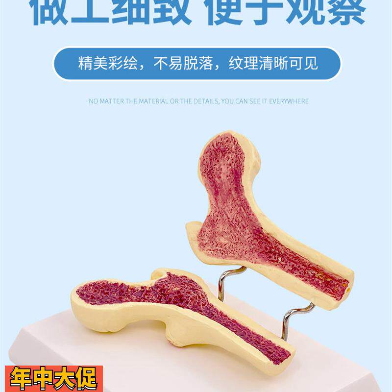 人体股骨头脊柱脊椎解剖切面对比模型骨质疏松病变骨骼骨架医学用