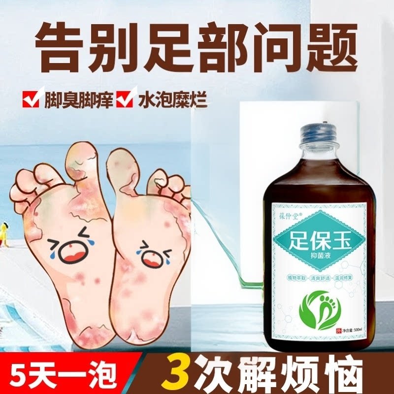 脚气喷剂止痒脱皮杀菌烂脚丫药脱皮糜烂脚趾缝脚臭喷雾泡脚去真菌