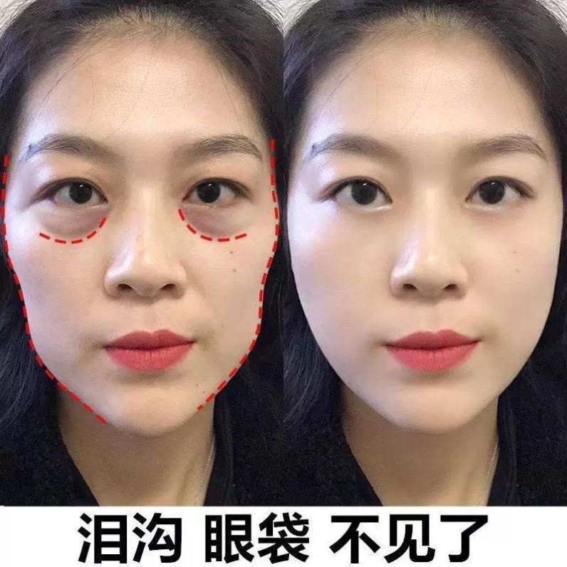 【李佳琪直播间推】跟泪沟说拜拜 眼部胶原蛋白贴膜眼袋19.9元1盒