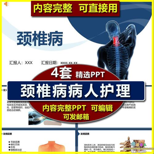 颈椎病病人护理查房ppt课件 颈椎病定义颈椎操临床表现治疗分型
