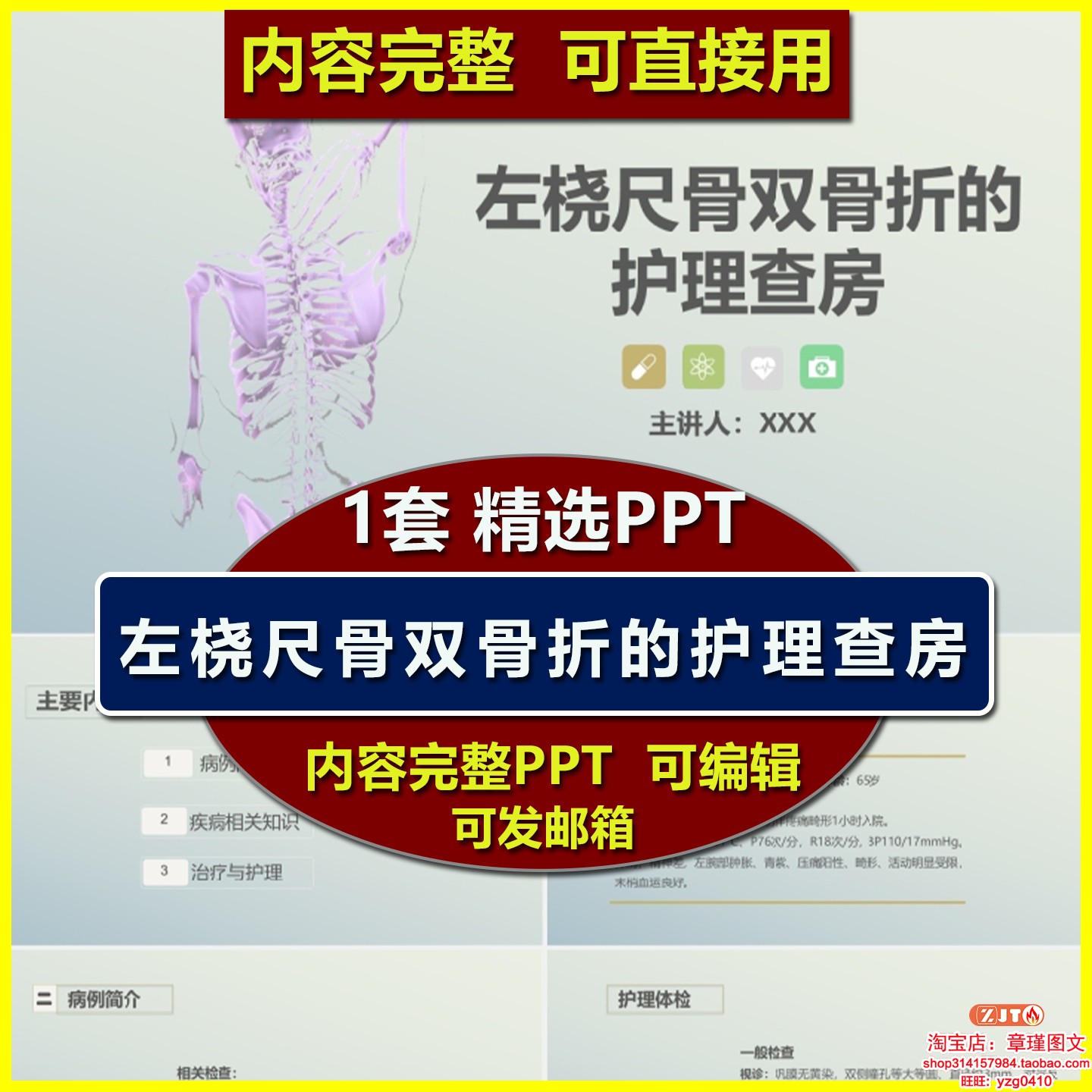 左桡尺骨双骨折的护理查房PPT课件治疗与护理业务学习