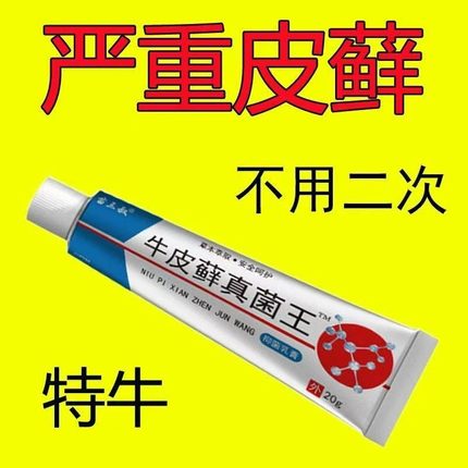 股藓大腿内侧根皮肤瘙痒真菌感染牛皮癣银屑药体股癣去湿疹止痒膏