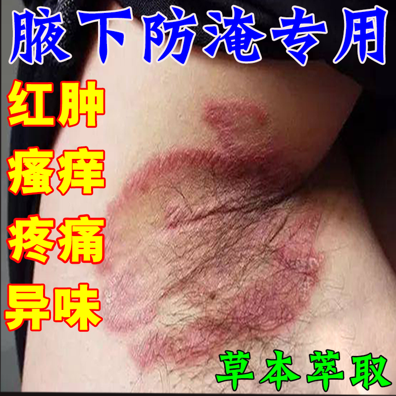腋下防淹胳肢窝红肿痒腋下出汗多疼异味汗液刺激膏