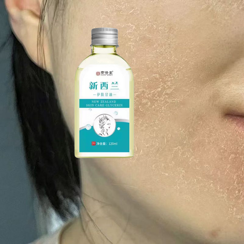 脸上长皮脸上皮面部脸痒脸上起皮干燥脸干掉皮脸部过敏脸痒去痒油