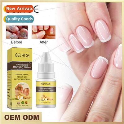 Ginseng Gray Nail Essence Nail Thickening Nail Repair Nutrit