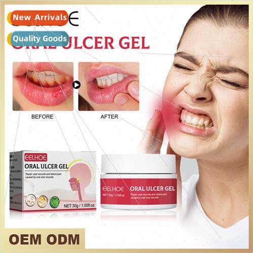 Oral Repair Gel Soothing Blistering Gums Gums Fire Oral Trau