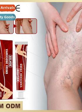 Vein Massage Varicose Vein Cream Relieves Bumped Blood Vesse