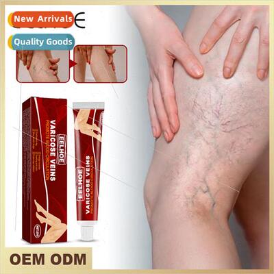 Vein Massage Varicose Vein Cream Relieves Bumped Blood Vesse