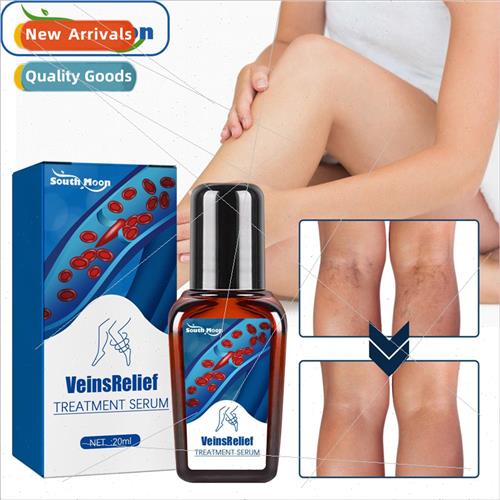 Vein Repair Solution Relieves Painful Varicose LegsEarthworm