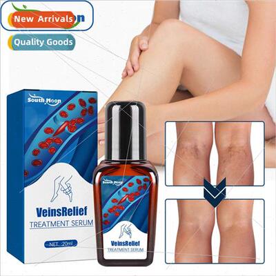 Vein Repair Solution Relieves Painful Varicose LegsEarthworm