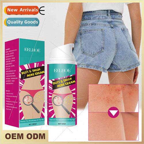 Hip Thigh Acne Cream ghtens Body Back Hip Thigh Acne Acne Cl