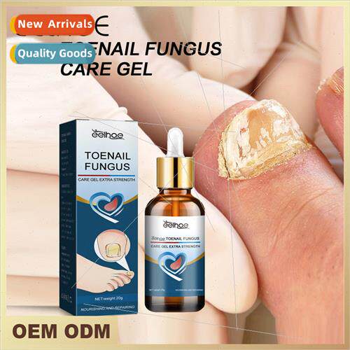 Toe Nail Care Gel Repair Hand and Foot Nails Gray Nail Nail