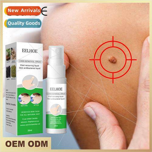 Wart Removal Wart Removal Wart Removal Wart Removal Wart Rem