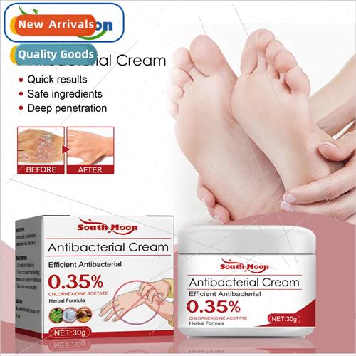 Psoriasis Treatment Cream Body Skin Redness Itchy Hands and