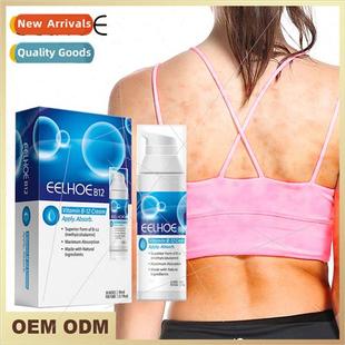 Psoriasis Treatment Cream Stop Itch Repair Skin Relief Redne