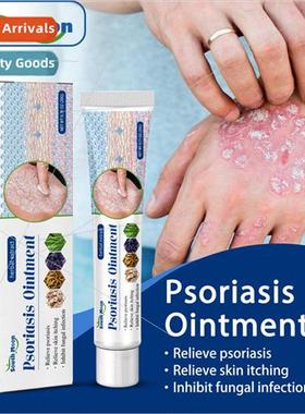 Skin Itch Relief Cream Dry Itchy Itchy Skin Itchy Skin Rash