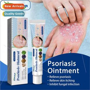 Itch Itchy Relief Dry Rash Cream Skin