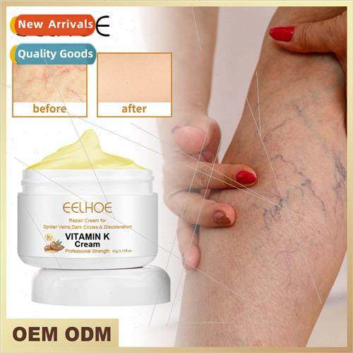 Vitamin K Cream Leg Bruising Bumps Swelling Earthworm Legs M