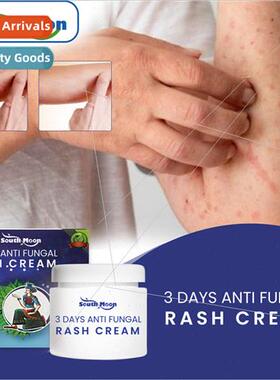 Skin Repair Cream Repair the skin barrier of dermatophytes t