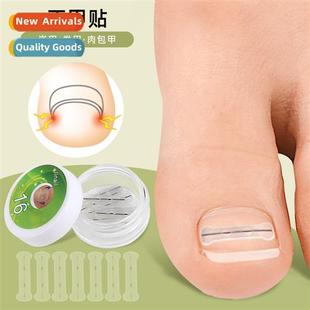 nails nail curly flesh nch toenail stickers posive New