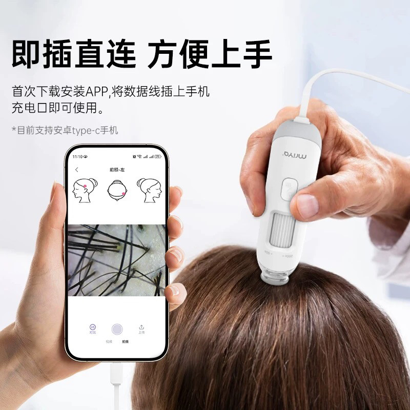 苹果安卓新款头皮检测仪毛囊皮肤检测清便携式家用美容院养发馆