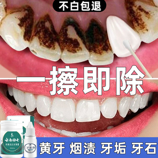 洗牙粉去黄美白牙齿黑污垢变亮白烟渍清洁神器去除牙结石速效溶解