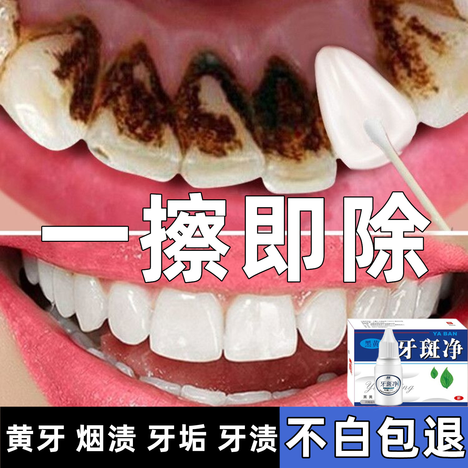 牙膏美白去黄去口臭强力去除牙齿烟渍牙垢牙结石神器溶解男士专用