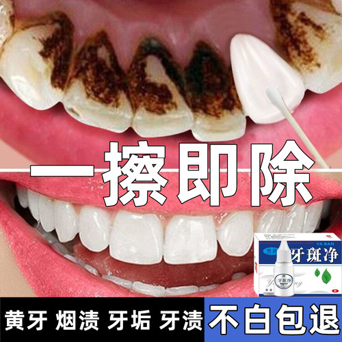 牙膏美白去黄去口臭强力去除牙齿烟渍牙垢牙结石神器溶解男士专用
