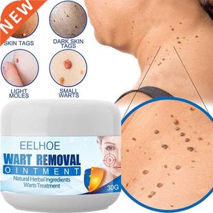 Cream Treatment Painless Skin Remover The Nec Wart