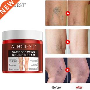 AUQUEST Varicose Veins Treatment Cream Relieve Tired Legs Di