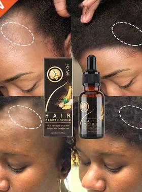 Hair Growth Products Sevich Ginger Essence Hair Growing Esse