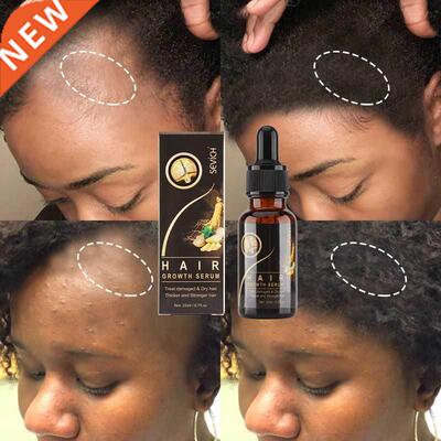 Hair Growth Products Sevich Ginger Essence Hair Growing Esse