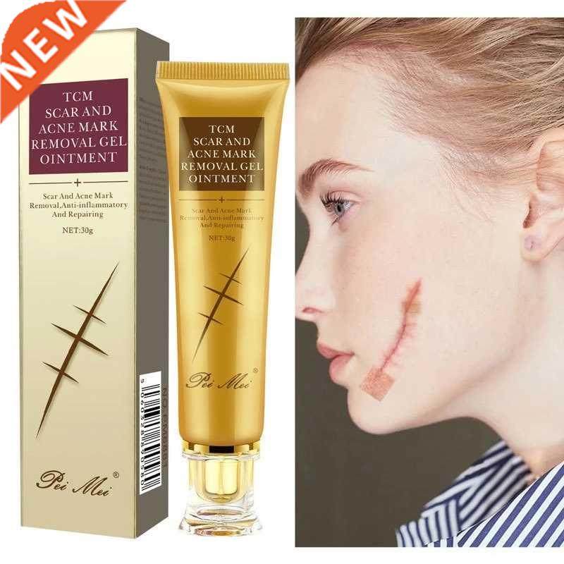 stretch marks removal scar acne treatment face whitening pim