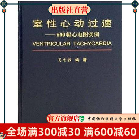 室性心动过速—600幅心电图实例 夏宏器编著 中国协和医科大学出版社
