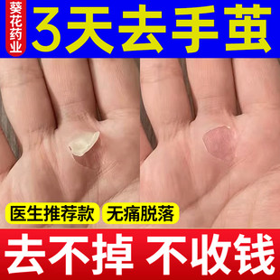 葵花茧洁士去手茧子神器手茧去除软化剂草本清茧灵茧立净鸡茧药膏
