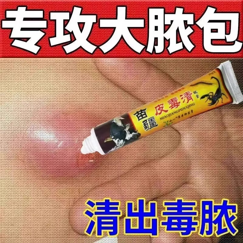 苗疆火疖子拔毒拔脓膏 脸部头部痘痘浓包屁股坐板疮痘痘吸脓神器
