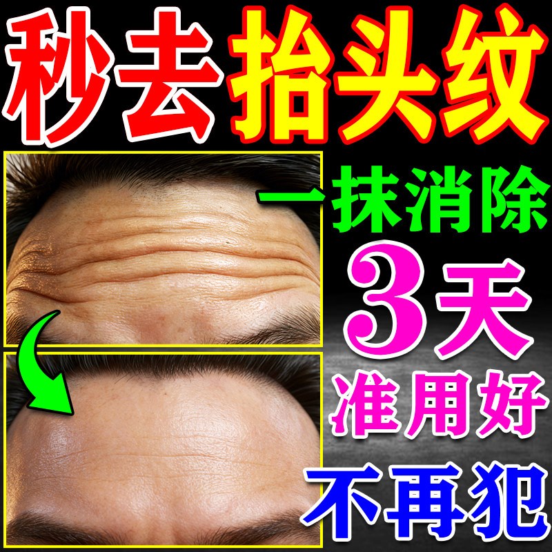 抬头纹去除男士专用神器抗皱额头抬头纹川字纹额头皱纹去专用提拉