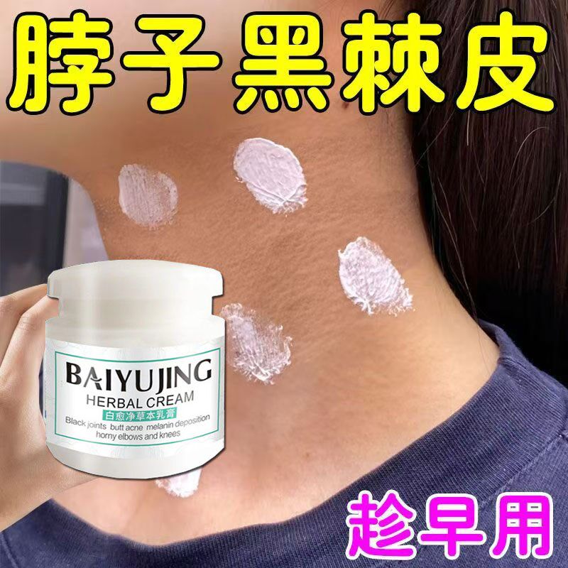 屁股去黑痘印坐印膏疤痕淡化黑色素沉淀去除部腋窝黑印臀部发黑膏