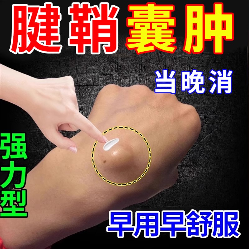 消腱鞘囊肿手背鼓包护腕关节发炎手腕酸疼结长期劳损挤压肿胀硬块