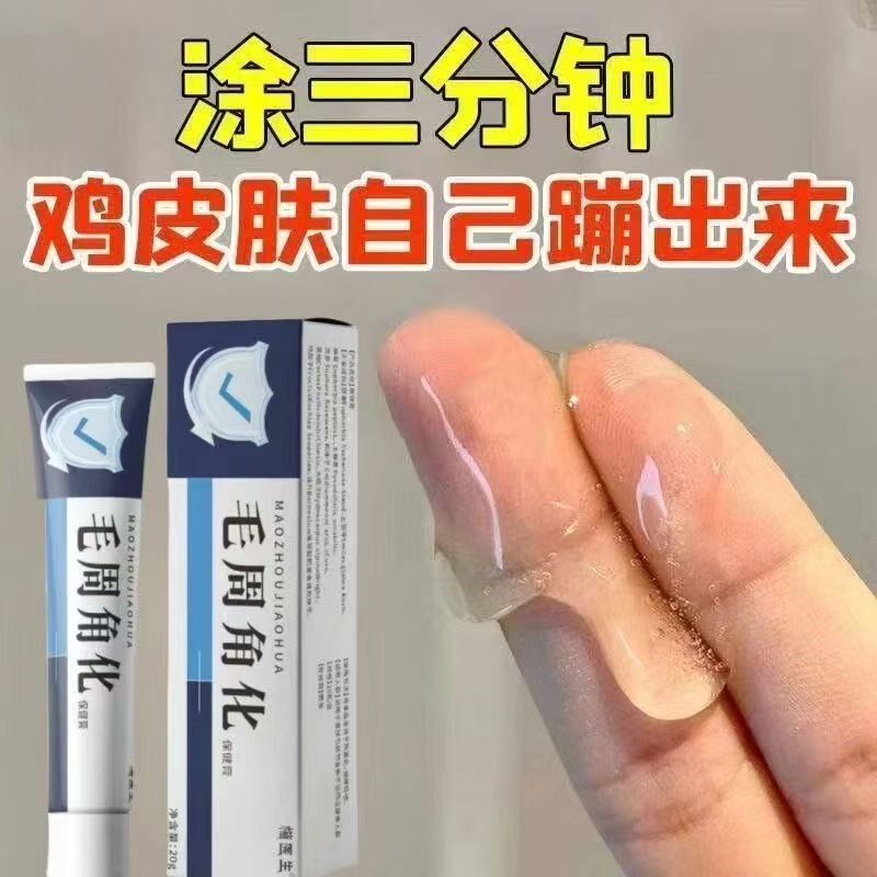 毛周角化膏去除鸡皮肤腿部脸部重度手臂去角质毛囊干燥蜕皮全身