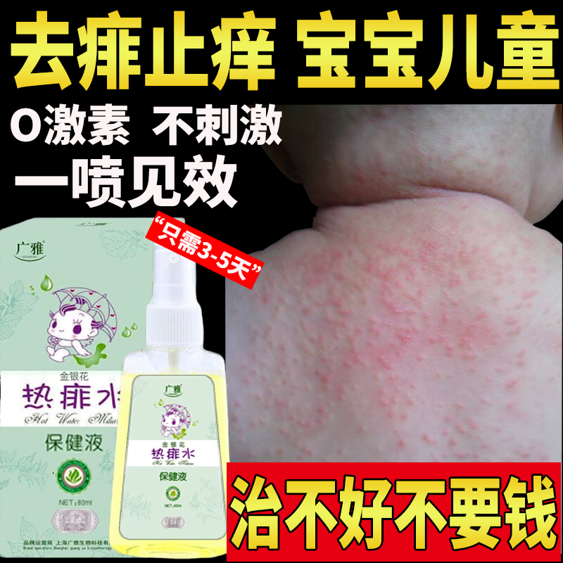 热痱子止痒水成人儿童宝宝身上去痱喷雾祛痱膏防婴儿专用粉除长菲