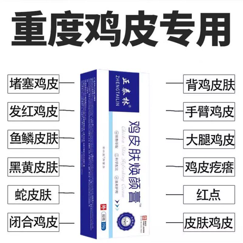 鸡皮肤焕颜膏去除鸡皮肤疙瘩神器毛囊角质症角化霜炎鱼鳞蛇皮药膏