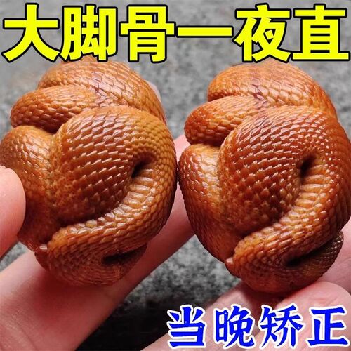 【十万人已矫正】拇指外翻矫正器治大母脚趾外翻分趾矫正器专用贴