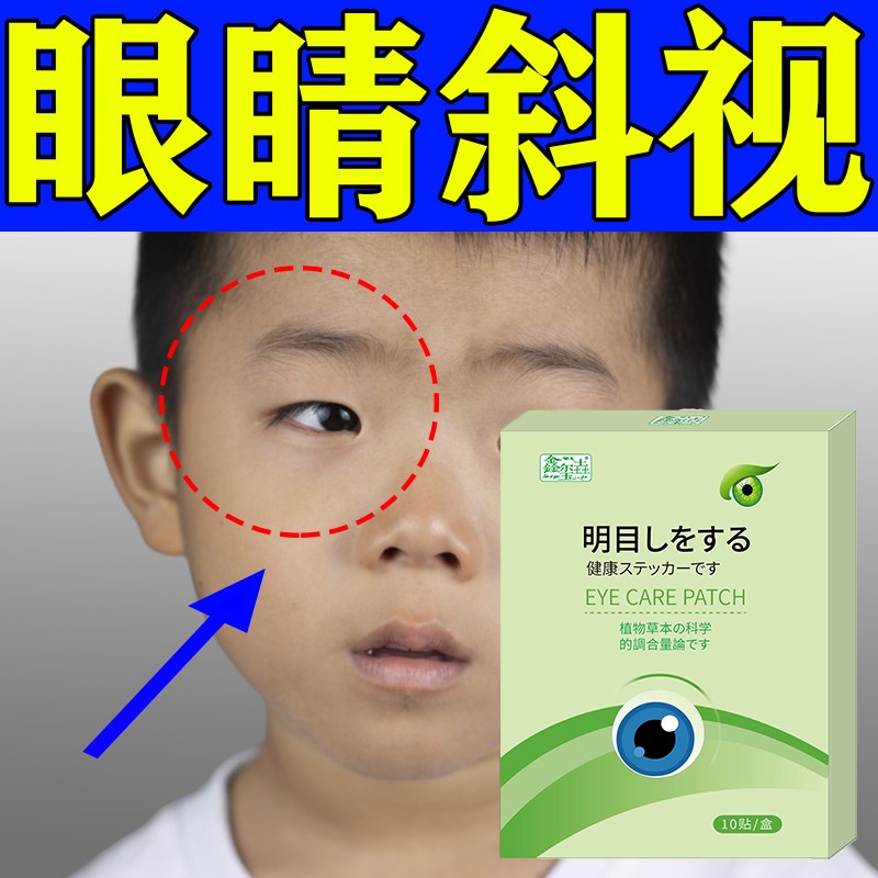 眼睛斜视眼位异常眼睛视物模糊视力下降视疲劳眼睛酸胀不适畏光