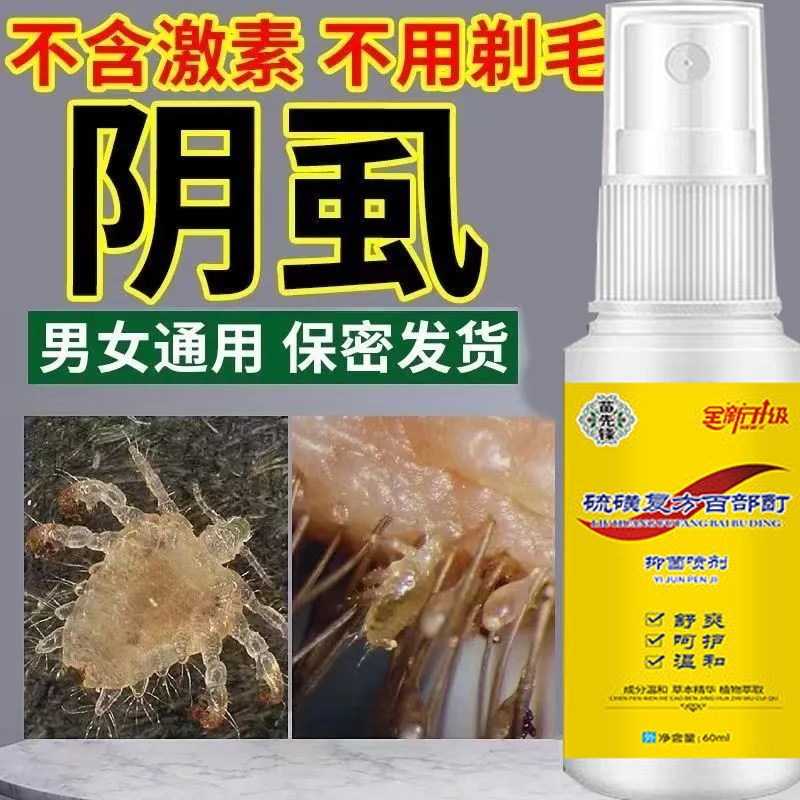 百部酊灭阴虱止痒喷剂药男士成人用女士私处阴狮子除虱立净喷雾治