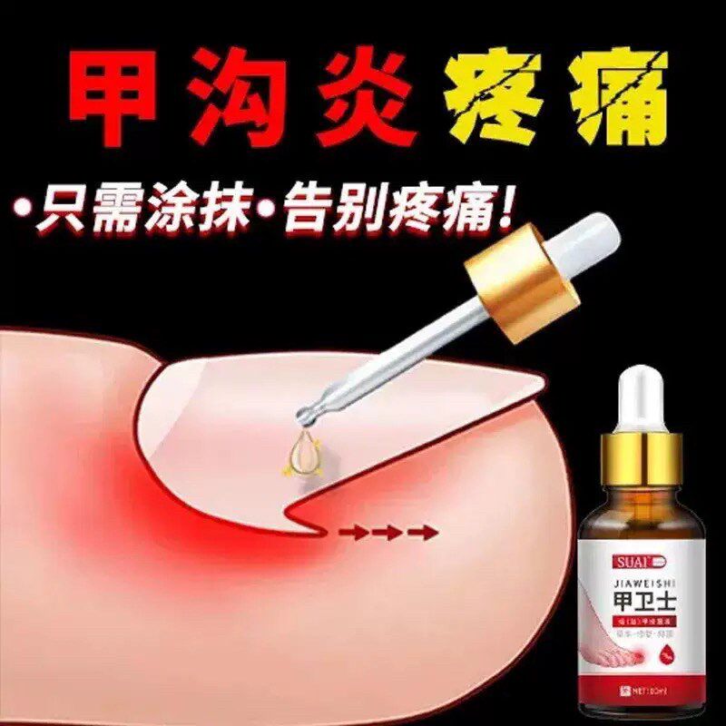 甲卫士专治甲沟炎痛神器肉芽化脓红肿嵌甲走路疼草本镇痛抑菌药水