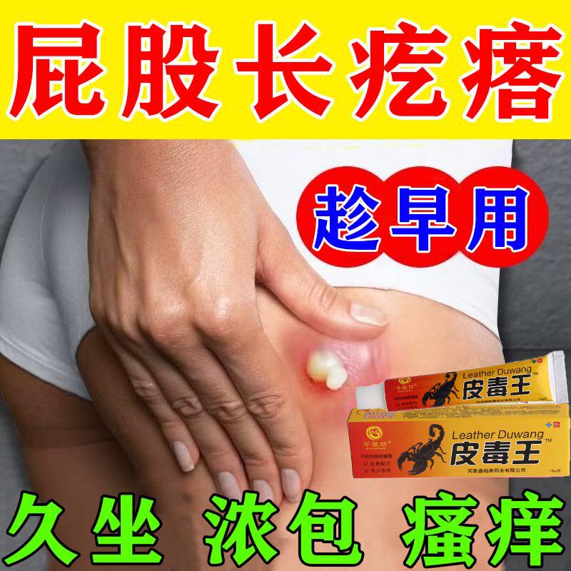 火疖子拔毒膏贴疖子脓包拔毒拔脓膏拔毒膏软膏痘痘坐板疮拨毒膏